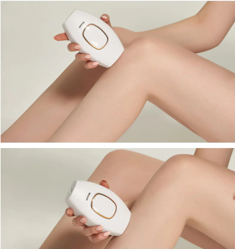 Hair Removal