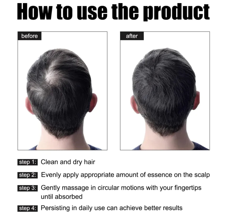 Men's Hair Growth Nutrition Essence