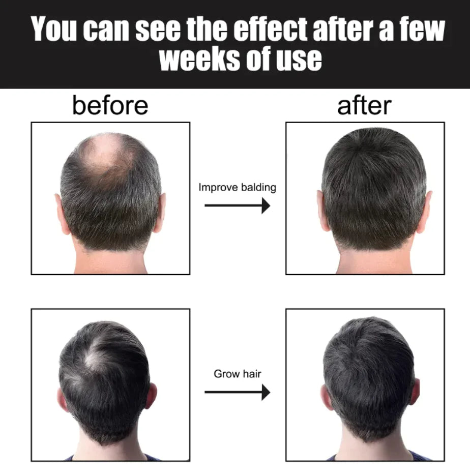 Men's Hair Growth Nutrition Essence