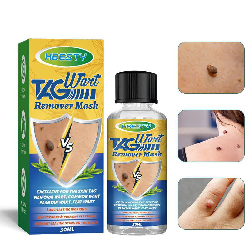 Herbal Mole Removal Solution – Natural & Effective